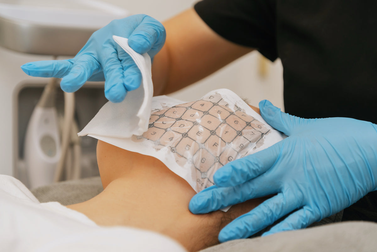 Thermage FLX treatment in progress at BioPlus Richmond