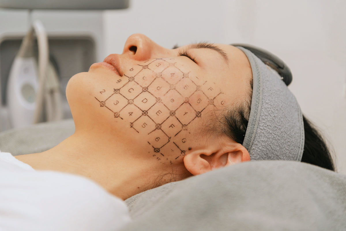 BioPlus Richmond — the home of Thermage FLX in BC