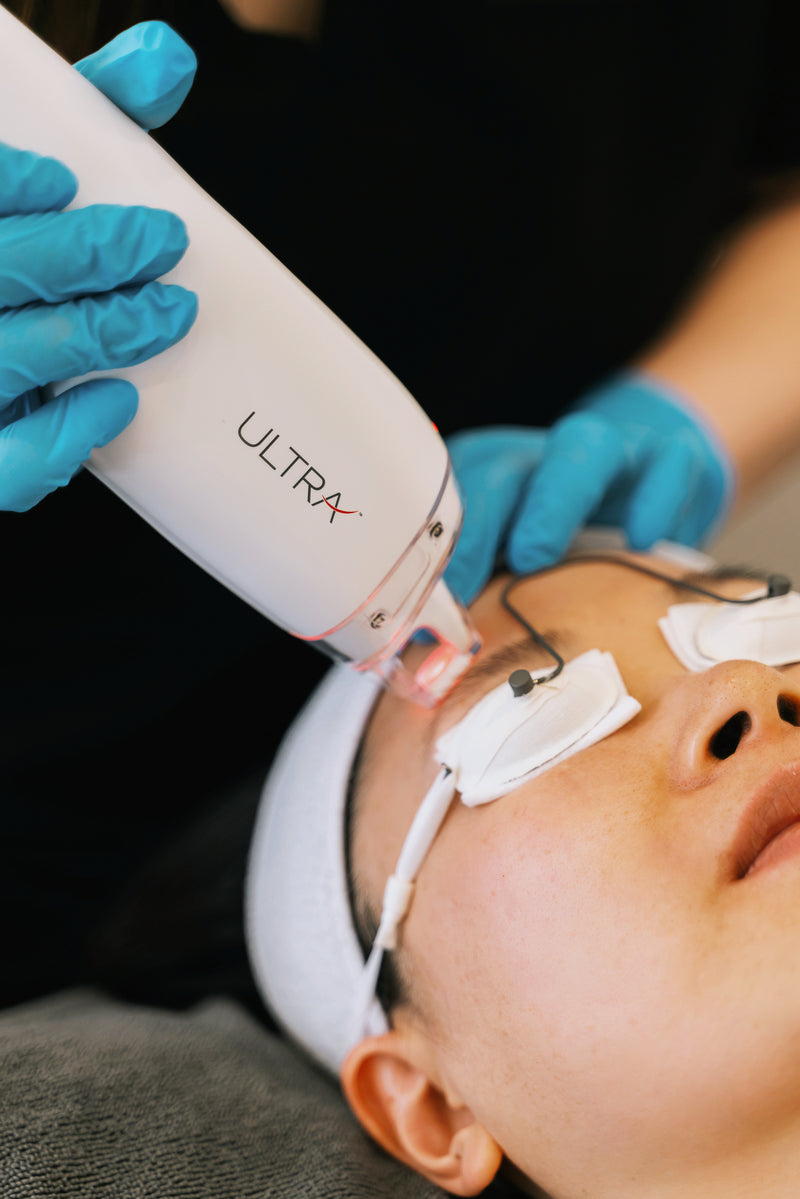 LaseMD Ultra