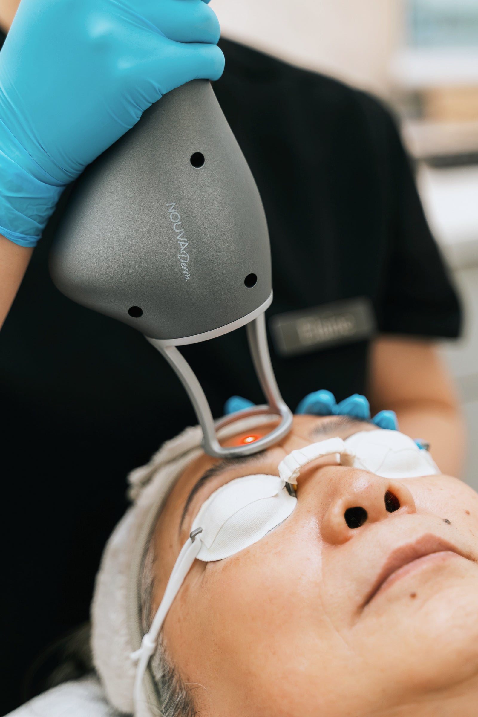Experience the NouvaDerm Thulium Laser