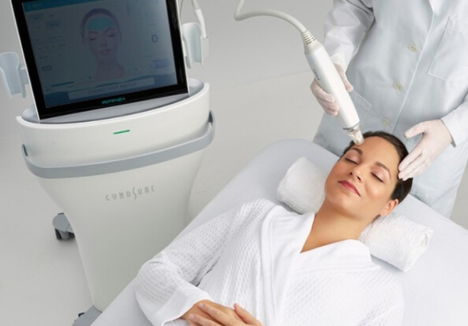 rf microneedling treatment